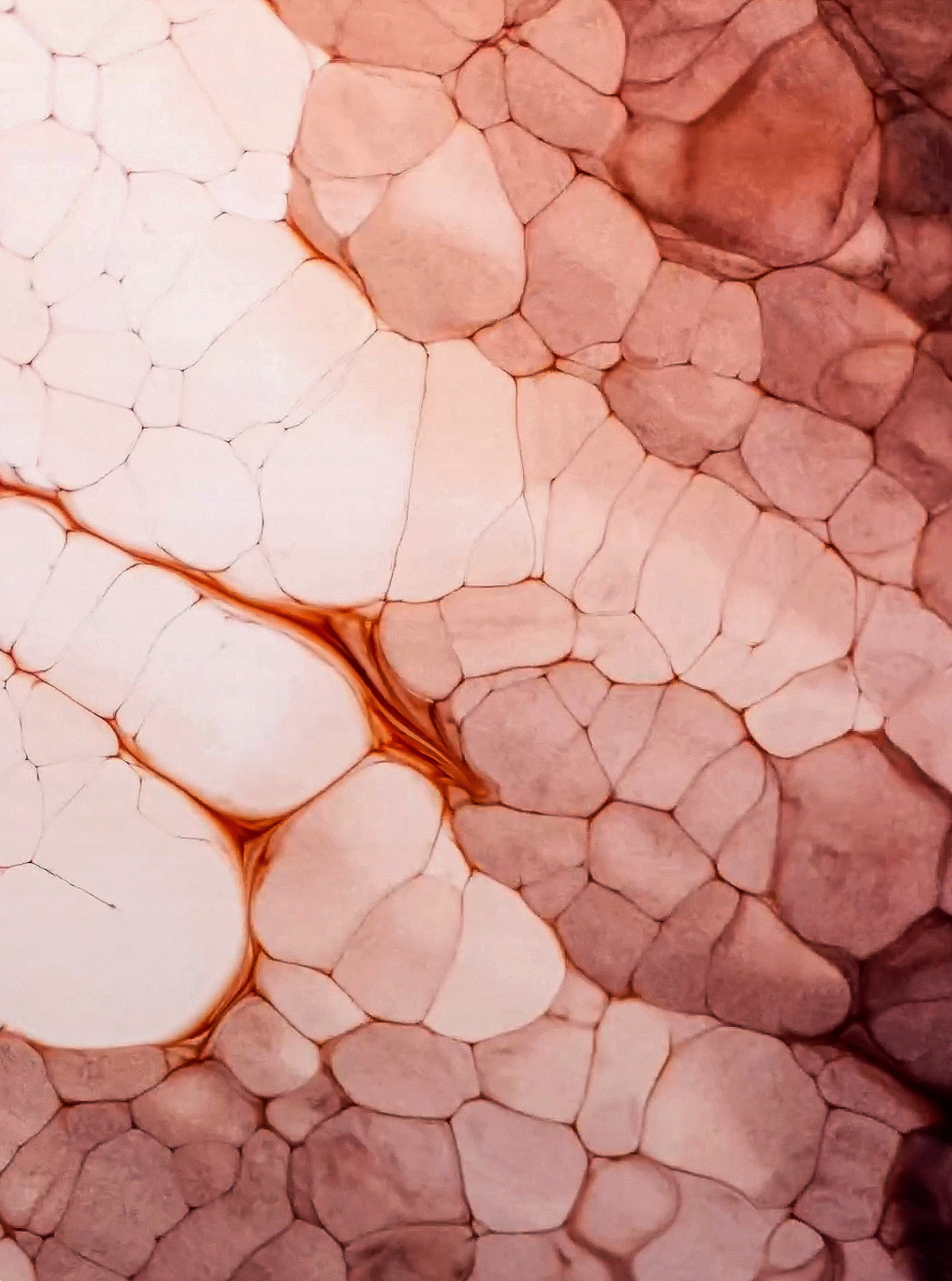 Greystone wellness experience